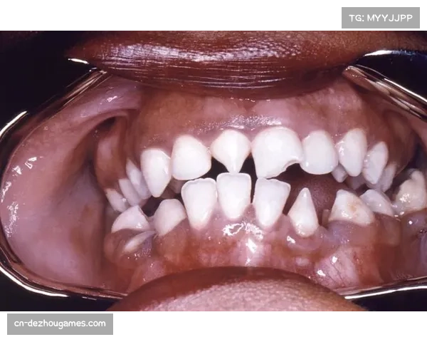 1986年“震颤”杜兰与哈格勒之战四十年回顾